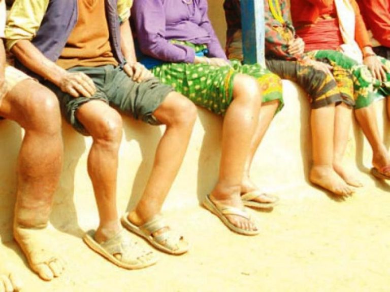 हात्तीपाईलेको औषधि नखाइदिंदा पुनः अभियान संचालन गर्नुपर्ने बाध्यता